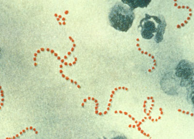 人食いバクテリア